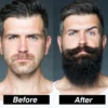 4Pcs-set-Men-Beard-Growth-Kit-Professional-Hair-Growth-Enhancer-Set-Beard-Care-Nourishing-with-Beard-8 Men's Beard Growth Kit - Professional Enhancer Set